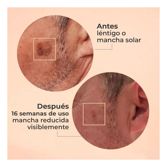Segle Clinical Glicolmix Solución Exfoliante 20% AHA 30ml Segle Clinical Glicolmix Solución Exfoliante 20% AHA 30ml