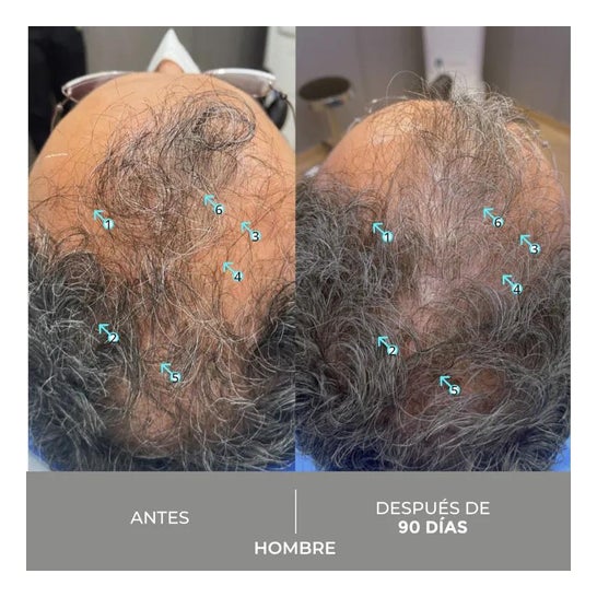 Spectral Dnc-S + Anti-Gray Serum 60ml Spectral Dnc-S + Anti-Gray Serum 60ml