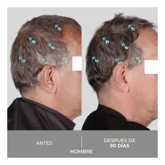 Spectral Dnc-S + Anti-Gray Serum 60ml Spectral Dnc-S + Anti-Gray Serum 60ml