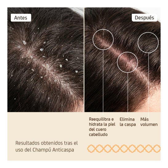 Champô epigenético anticaspa Nuggela &amp; Sulé 250ml