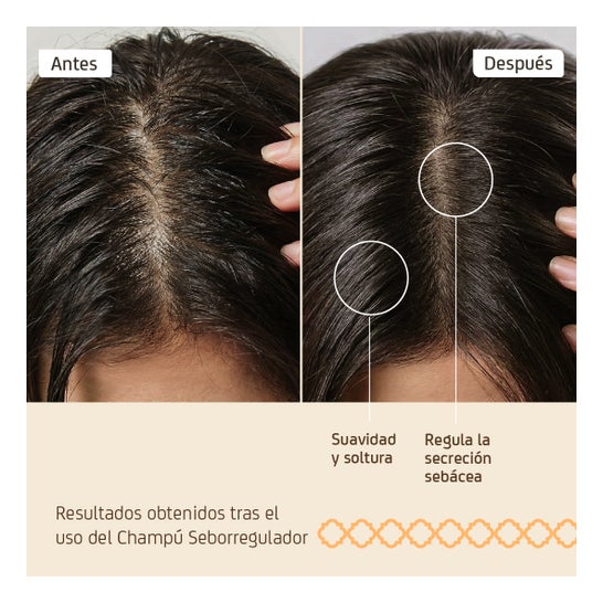 Champô epigenético Nuggela &amp; Sulé 250ml de cabelo oleoso