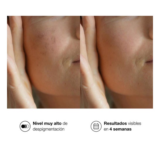 Bella Aurora Bio10 Forte Bio10 M-Pigmenting M-Lasma 30ml