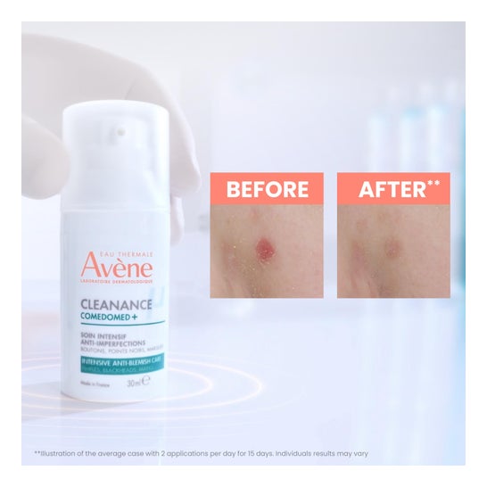 Avene Cleanance Comedomed Concentrado Anti-Imperfeição 30 Ml