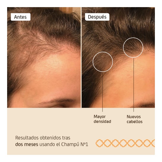Shampoo Nuggela &amp; Sulé Extrato de Cebola 100ml
