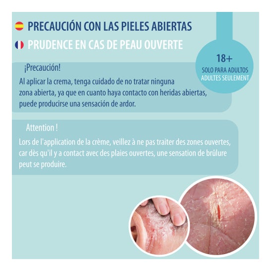 Behrend Homecare Psoriasis & Neurodermitis Creme Intensiv 50ml