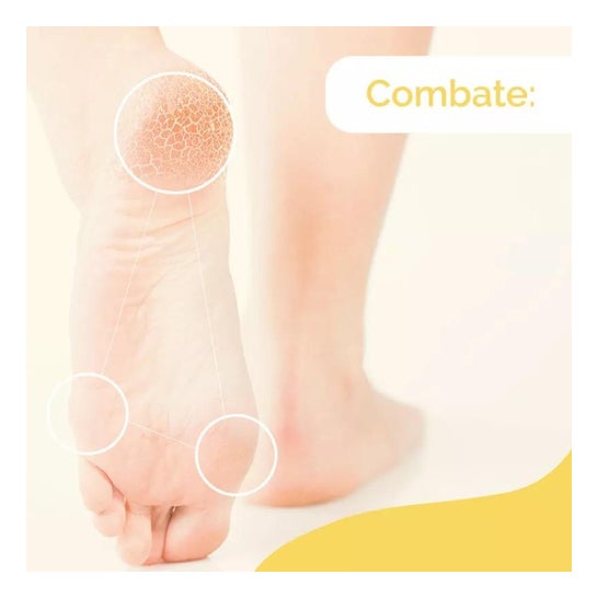 Scholl pés de creme de dureza 60ml Scholl pés de creme de dureza 60ml