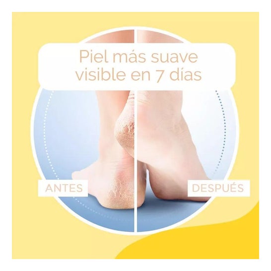 Scholl pés de creme de dureza 60ml Scholl pés de creme de dureza 60ml