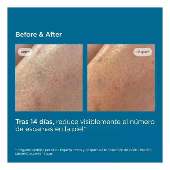 Loção Ureadin10 Hidratação Intensa 750ml Loção Ureadin10 Hidratação Intensa 750ml