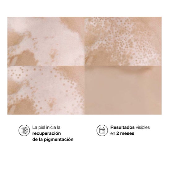 Bella Aurora Repigment12 Plus Cream 75ml