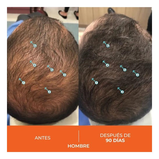 Revita Anticaida Capilar 30 Comprimidos Revita Anticaida Capilar 30 Comprimidos