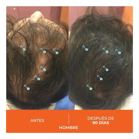 Revita Anticaida Capilar 30 Comprimidos Revita Anticaida Capilar 30 Comprimidos