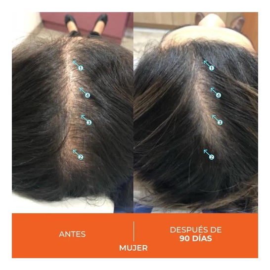 Revita Anticaida Capilar 30 Comprimidos Revita Anticaida Capilar 30 Comprimidos