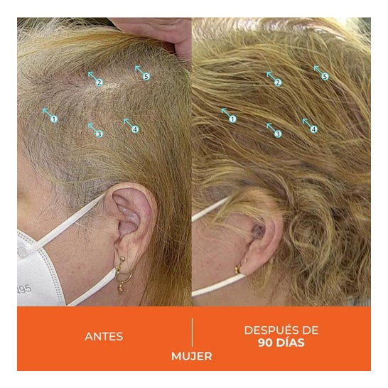 Revita Anticaida Capilar 30 Comprimidos Revita Anticaida Capilar 30 Comprimidos