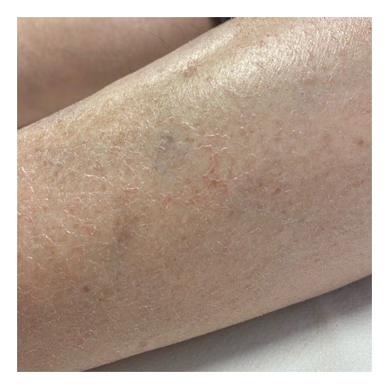 Isdin Ureadin Lotion10 Hidratação Intensa 100ml