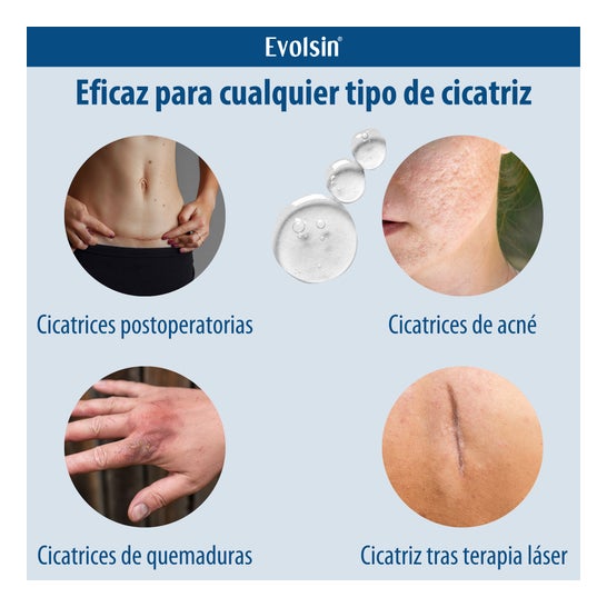 Evolsin Narben Gel para Cicatrizes 20g