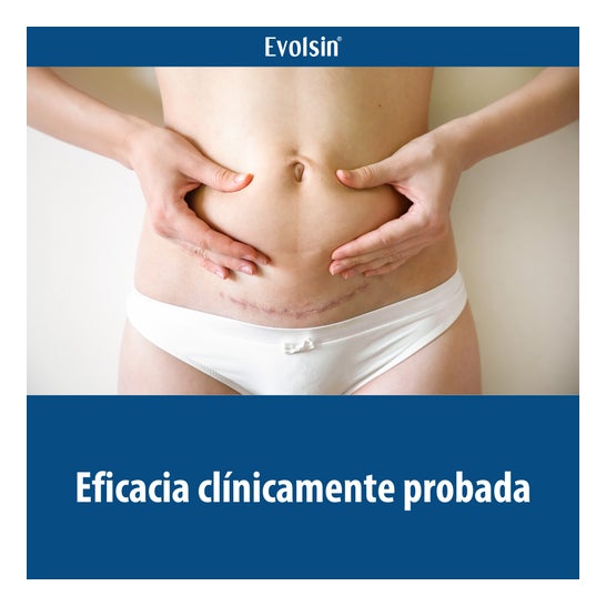 Evolsin Narben Gel para Cicatrizes 20g