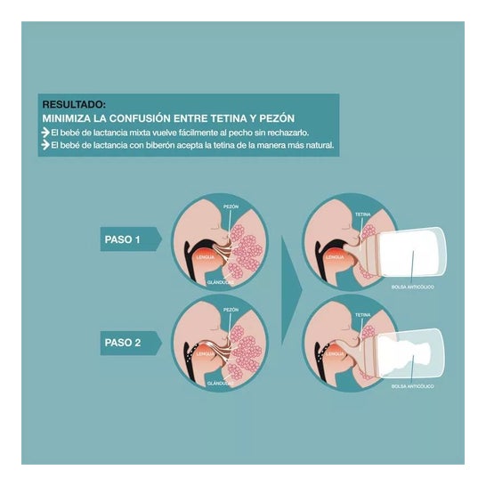 Suavinex Zero Zero Biberon Anticolico Silicona 1ud Suavinex Zero Zero Biberon Anticolico Silicona 1ud