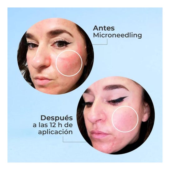 Segle Skin Factor Serum 30ml Segle Skin Factor Serum 30ml