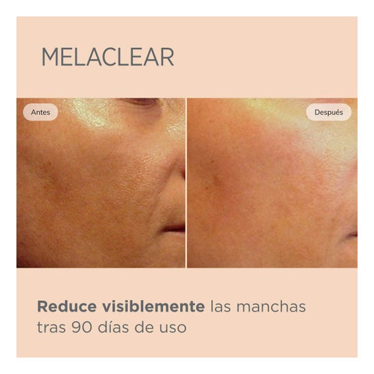 Isdinceutics Melaclear Sérum 15ml