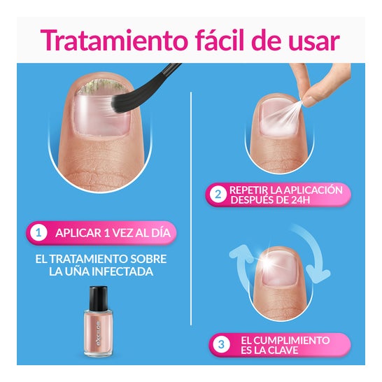 Excilor Forte Color Tratamento do Fungos das Unhas Nude 30ml