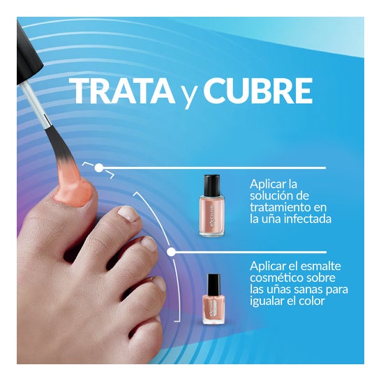 Excilor Forte Color Tratamento do Fungos das Unhas Nude 30ml