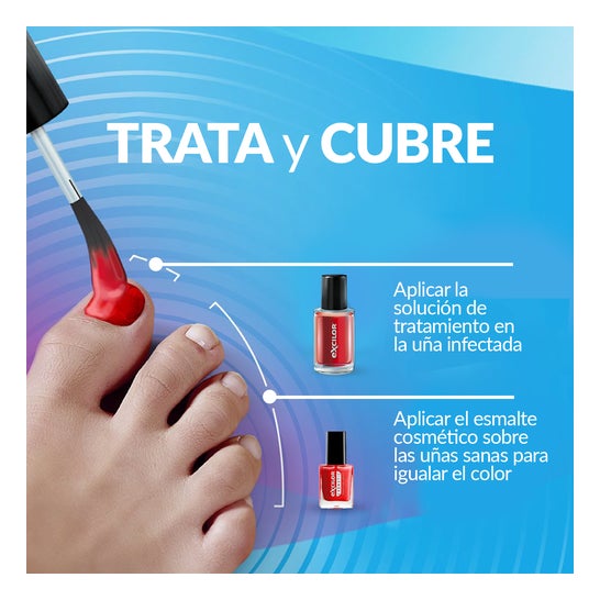 Excilor Forte Color Tratamento do Fungos das Unhas Red 30ml
