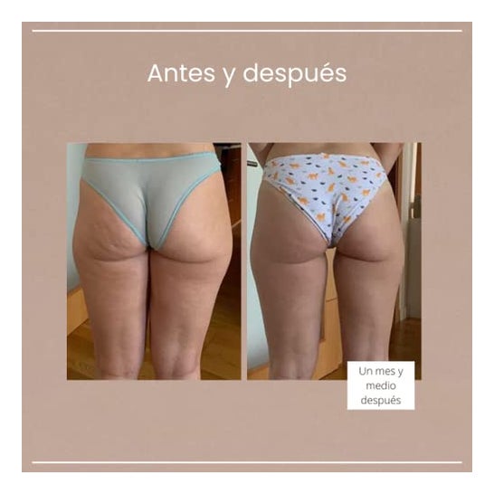 O meu gel queimador de gordura Rebotica efeito frio 500ml O meu gel queimador de gordura Rebotica efeito frio 500ml