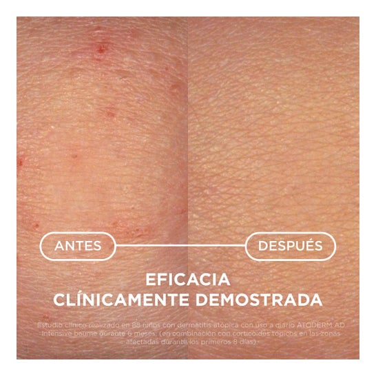 Bioderma Atoderm Intensive Baume Bálsamo Ultracalmante 200ml
