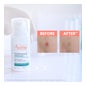 Avene Cleanance Comedomed Concentrado Anti-Imperfeição 30 Ml