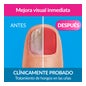 Excilor Forte Color Tratamento do Fungos das Unhas Red 30ml